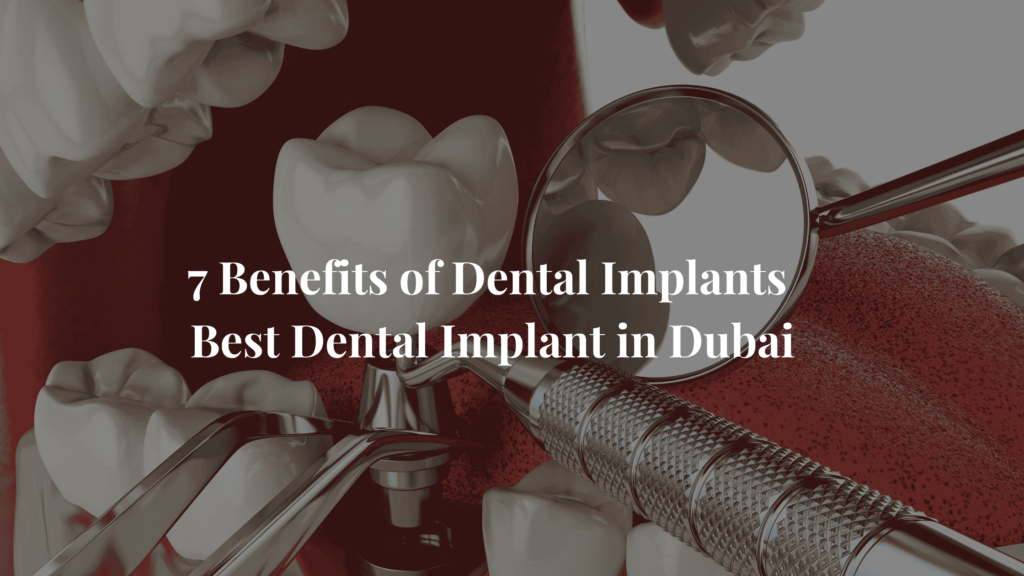 7 Benefits of Dental Implants in Dubai by dr ritul agarwal
