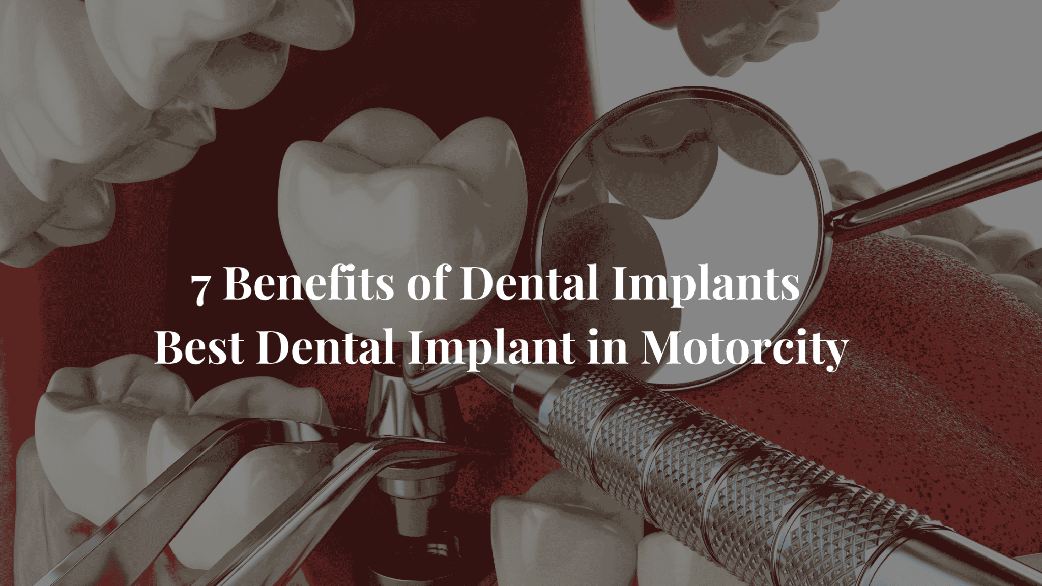 7 Benefits of Dental Implants in Motorcity by dr ritul agarwal