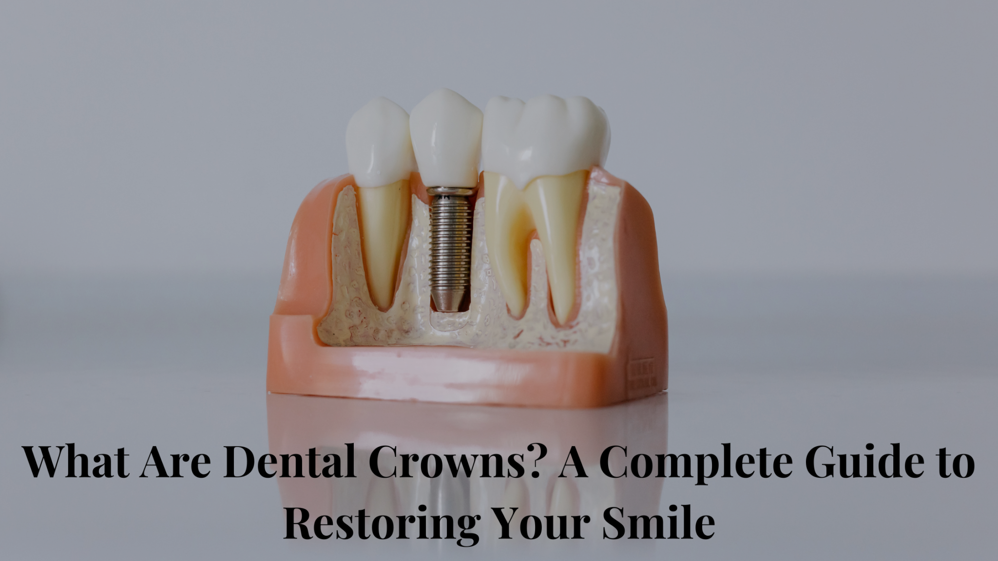 Dental Crowns A Complete Guide to Restoring Your Smile