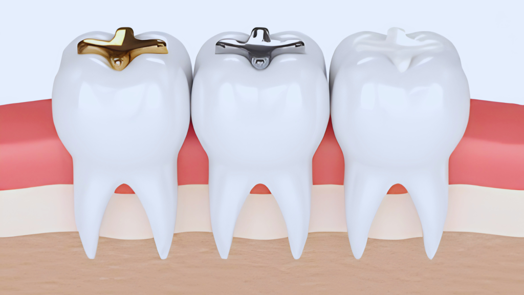 Cosmetic Fillings in Dubai