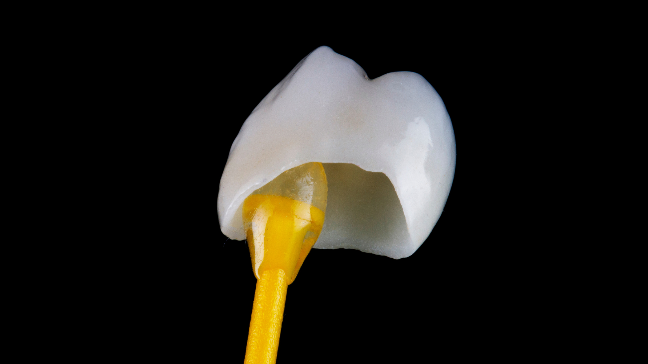 Dental Crown in Dubai