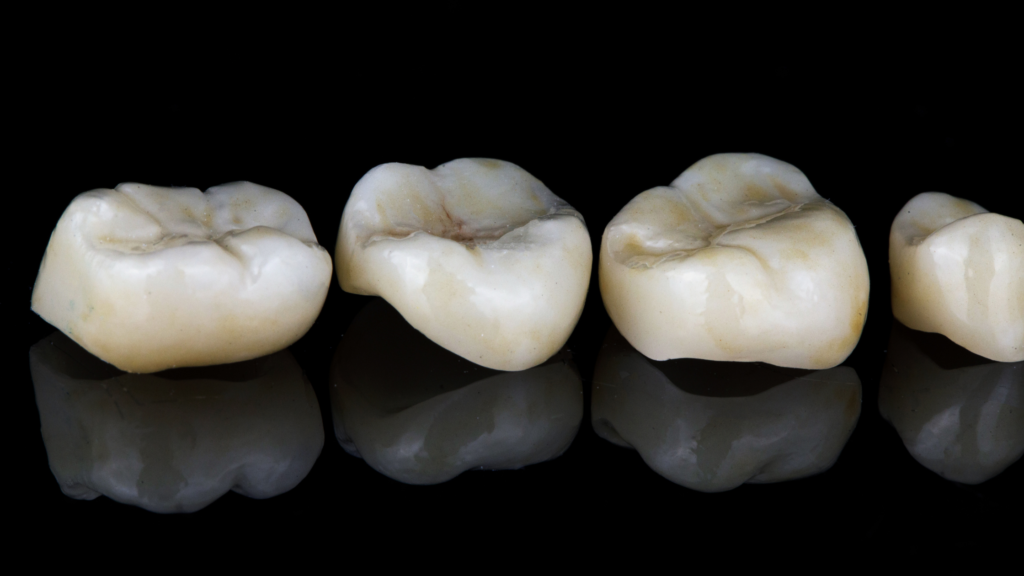 Dental Crown treatment in Motorcity
