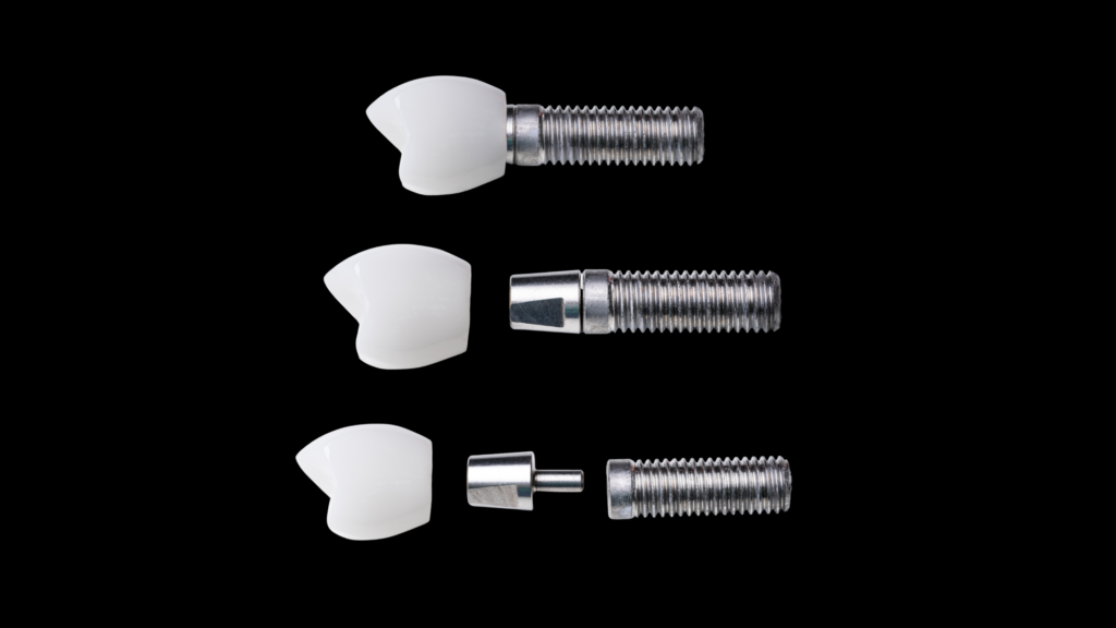 Dental Implants image