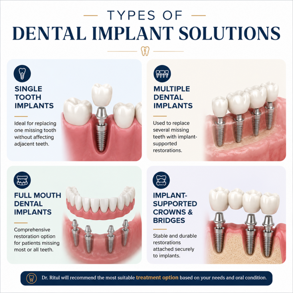 Types of dental Implants we provide