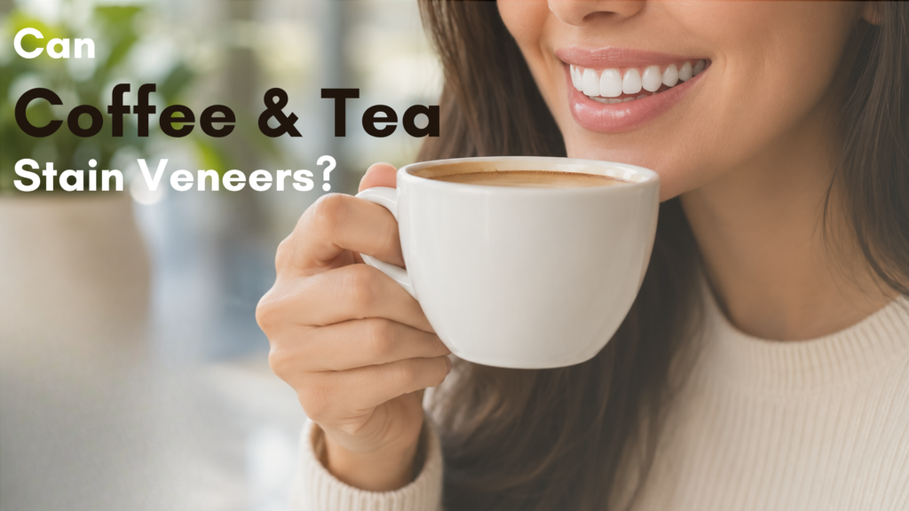 Can coffee or tea stain veneers or change color overtime?